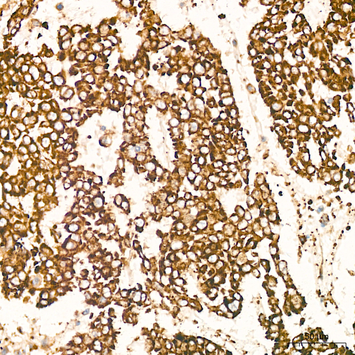 Peroxiredoxin 4 (PRDX4) Rabbit Monoclonal Antibody - Image 5
