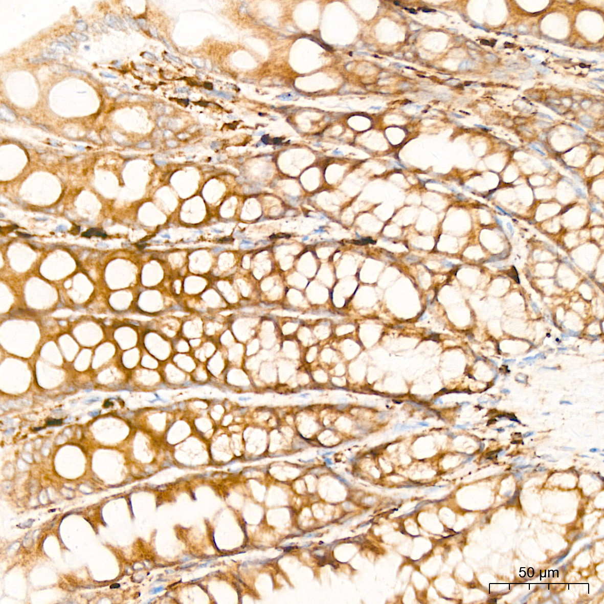Peroxiredoxin 4 (PRDX4) Rabbit Monoclonal Antibody - Image 6