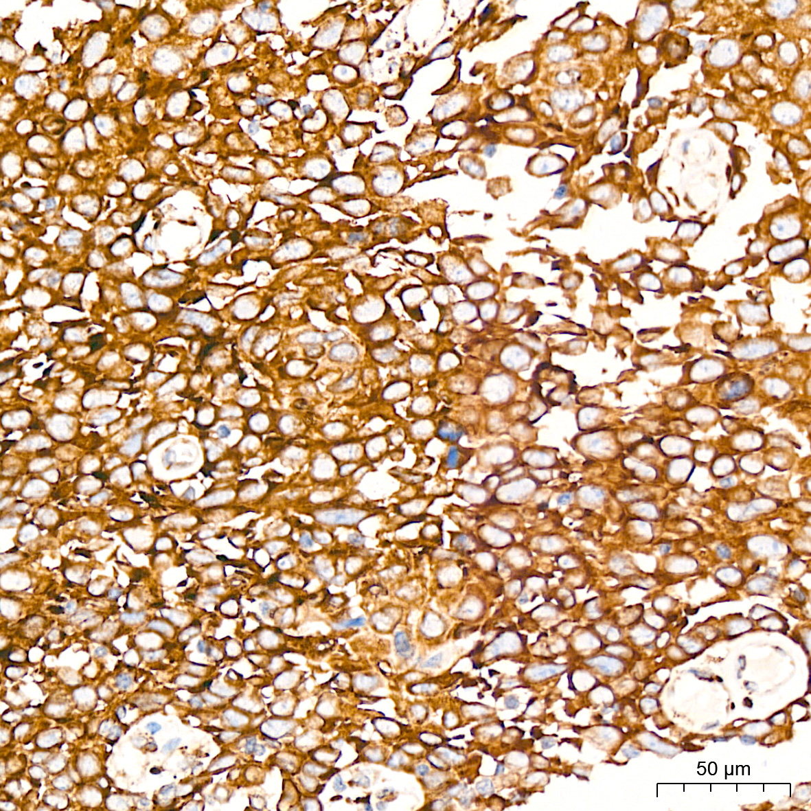 Peroxiredoxin 4 (PRDX4) Rabbit Monoclonal Antibody - Image 8