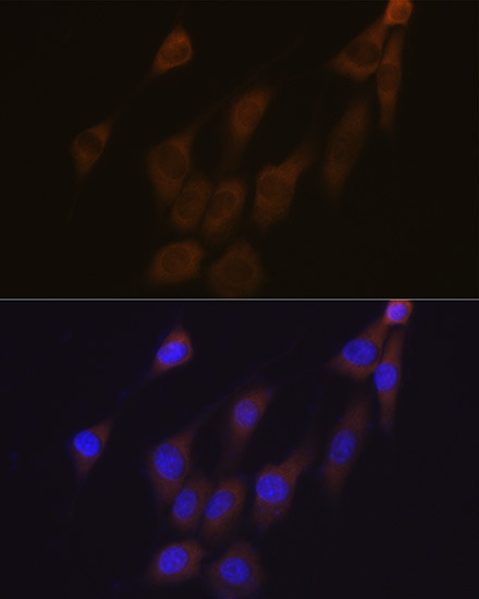 Peroxiredoxin 4 (PRDX4) Rabbit Monoclonal Antibody - Image 9