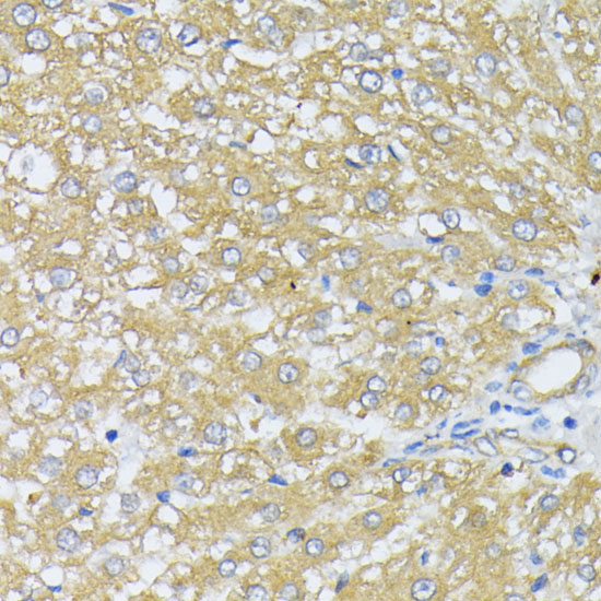 Peroxiredoxin 4 (PRDX4) Rabbit Polyclonal Antibody - Image 2