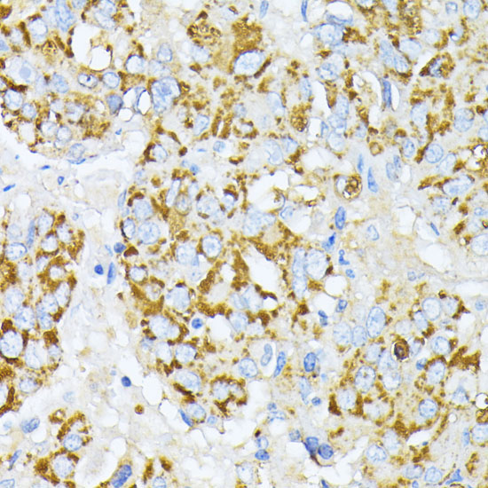 Peroxiredoxin 4 (PRDX4) Rabbit Polyclonal Antibody - Image 3