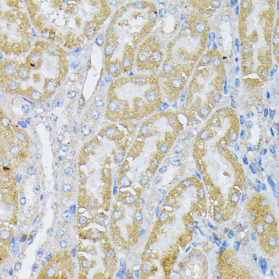 Peroxiredoxin 4 (PRDX4) Rabbit Polyclonal Antibody - Image 4