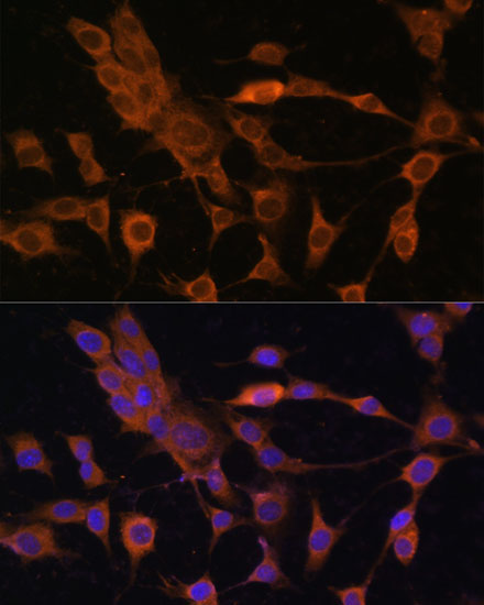 Peroxiredoxin 4 (PRDX4) Rabbit Polyclonal Antibody - Image 5