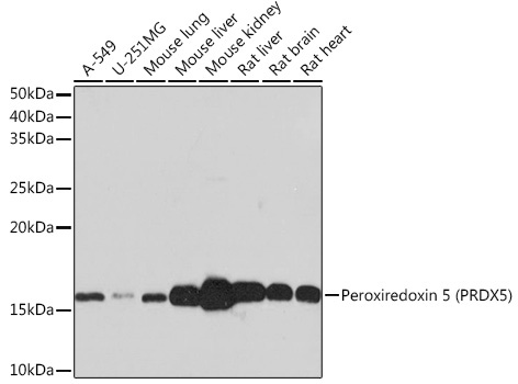 Peroxiredoxin 5 (PRDX5) Rabbit Monoclonal Antibody