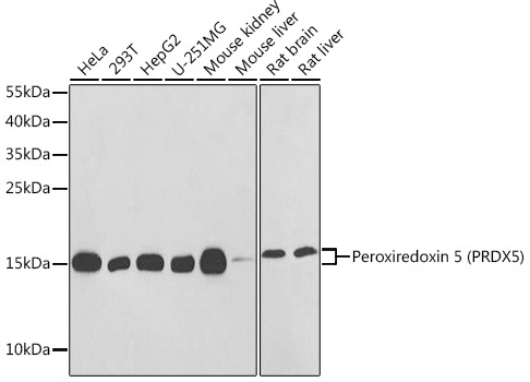 Peroxiredoxin 5 (PRDX5) Rabbit Polyclonal Antibody
