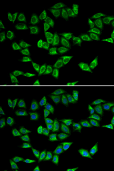 Peroxiredoxin 5 (PRDX5) Rabbit Polyclonal Antibody - Image 2
