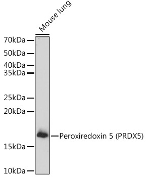 Peroxiredoxin 5 (PRDX5) Rabbit Polyclonal Antibody - Image 2