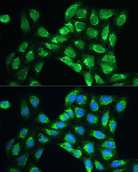 Peroxiredoxin 5 (PRDX5) Rabbit Polyclonal Antibody - Image 3