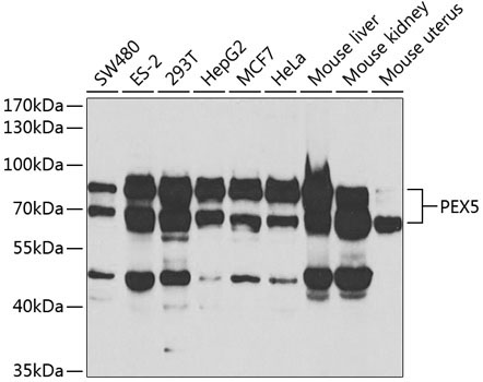 PEX5 Rabbit Polyclonal Antibody