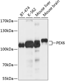PEX6 Rabbit Polyclonal Antibody