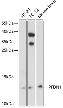 PFDN1 Rabbit Polyclonal Antibody