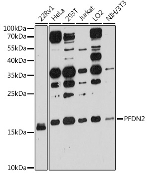 PFDN2 Rabbit Polyclonal Antibody