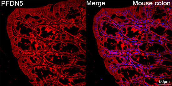 PFDN5 Rabbit Monoclonal Antibody - Image 2