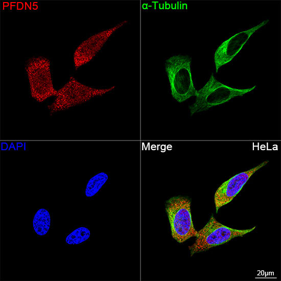PFDN5 Rabbit Monoclonal Antibody - Image 3