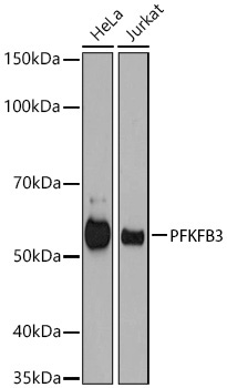 PFKFB3 Rabbit Monoclonal Antibody