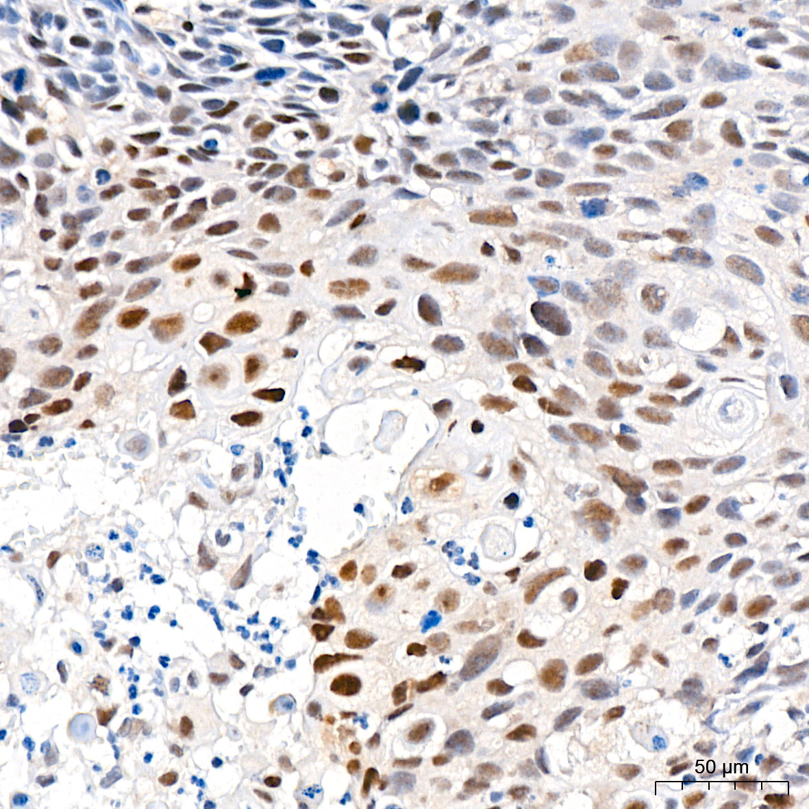 PFKFB3 Rabbit Monoclonal Antibody - Image 2
