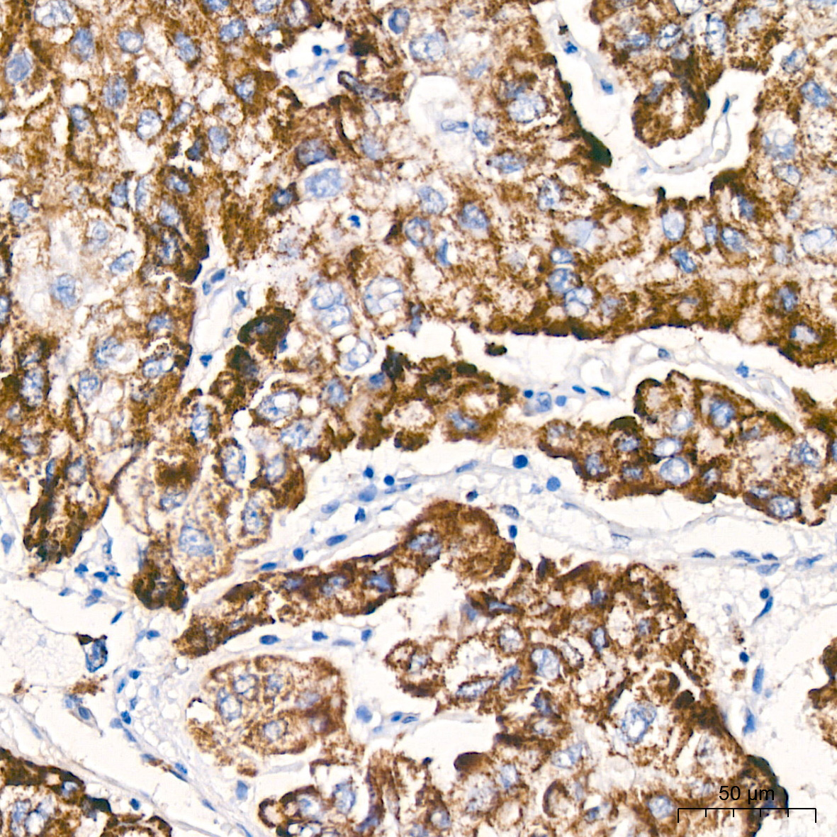 PFKFB3 Rabbit Monoclonal Antibody - Image 3
