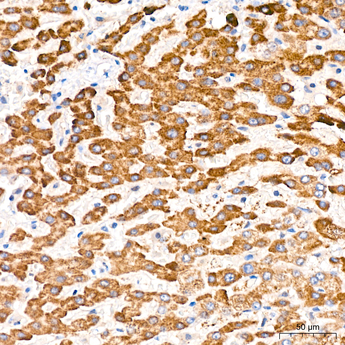 PFKFB3 Rabbit Monoclonal Antibody - Image 4