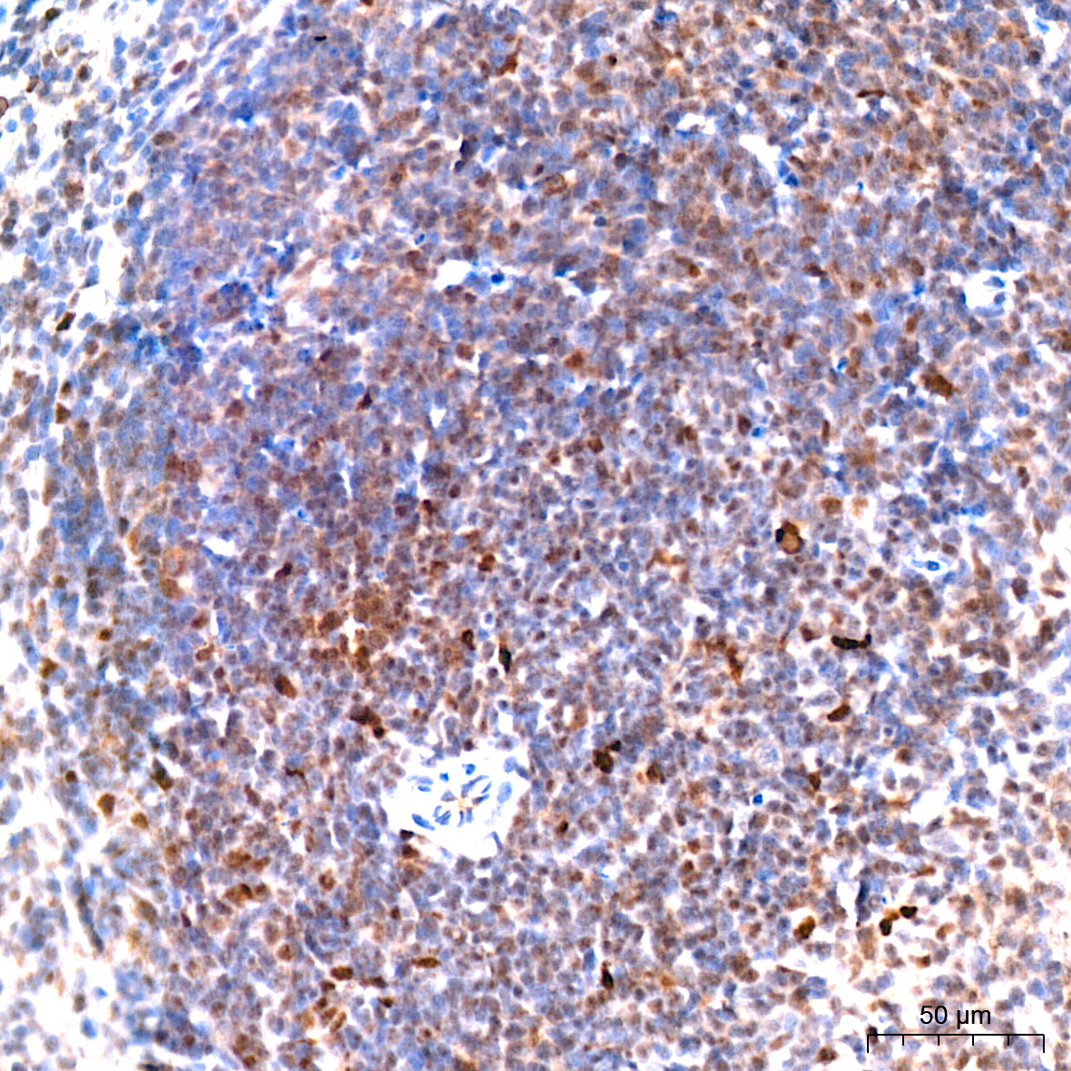 PFKFB3 Rabbit Monoclonal Antibody - Image 5