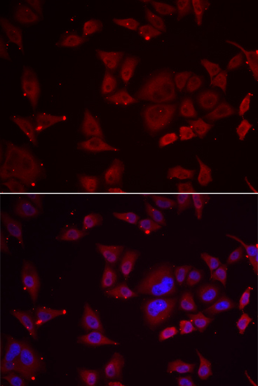 PFKFB3 Rabbit Polyclonal Antibody