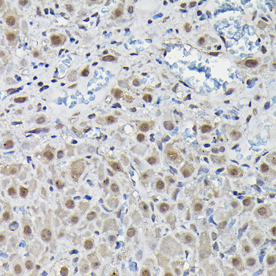 PFKFB3 Rabbit Polyclonal Antibody - Image 3