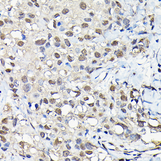 PFKFB3 Rabbit Polyclonal Antibody - Image 4