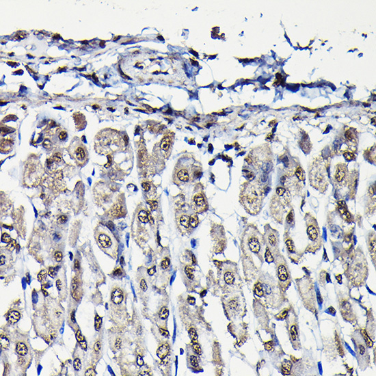 PFKFB3 Rabbit Polyclonal Antibody - Image 5