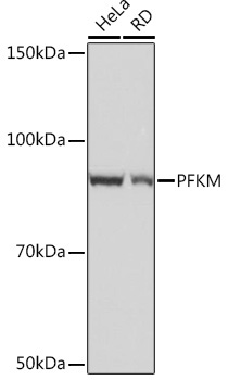 PFKM Rabbit Monoclonal Antibody