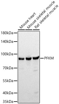 PFKM Rabbit Monoclonal Antibody - Image 2