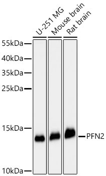 PFN2 Rabbit Polyclonal Antibody