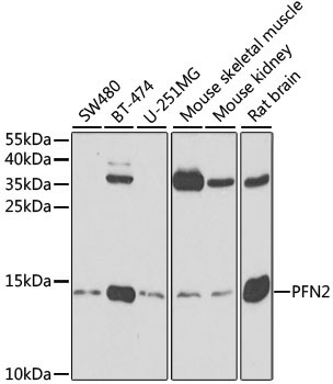 PFN2 Rabbit Polyclonal Antibody