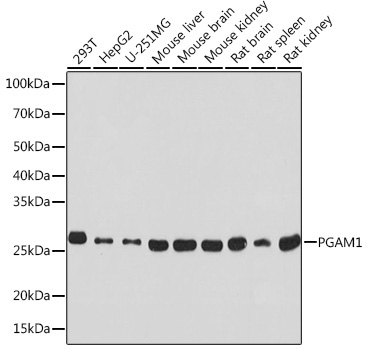 PGAM1 Rabbit Monoclonal Antibody