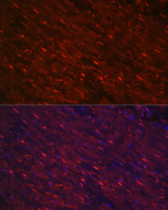 PGAM2 Rabbit Polyclonal Antibody - Image 2