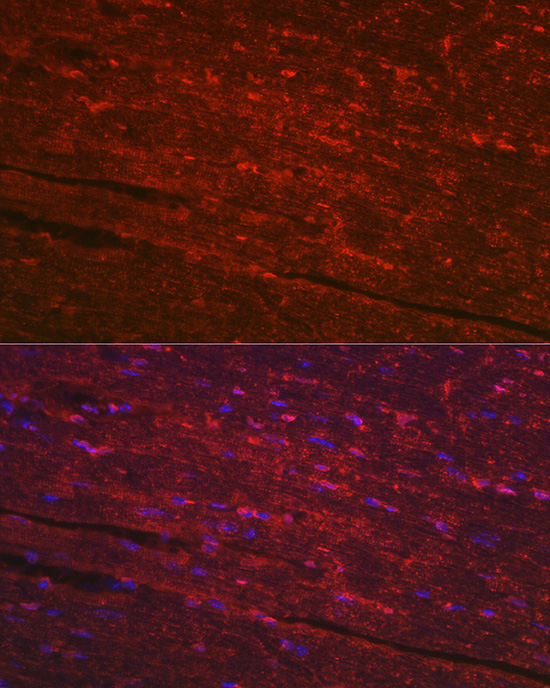 PGAM2 Rabbit Polyclonal Antibody - Image 3