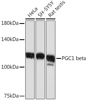 PGC1 beta Rabbit Monoclonal Antibody