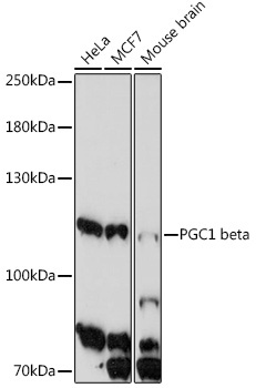 PGC1 beta Rabbit Polyclonal Antibody