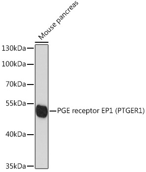 PGE receptor EP1 (PTGER1) Rabbit Polyclonal Antibody