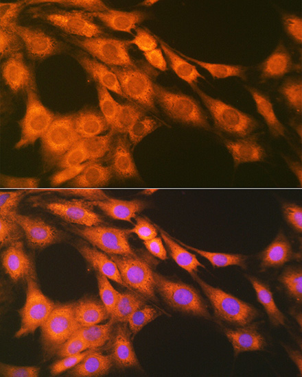 PGE receptor EP2 (PTGER2) Rabbit Monoclonal Antibody - Image 3