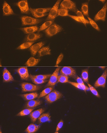 PGE receptor EP2 (PTGER2) Rabbit Monoclonal Antibody - Image 4