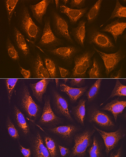 PGE receptor EP2 (PTGER2) Rabbit Monoclonal Antibody - Image 5