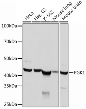 PGK1 Rabbit Monoclonal Antibody