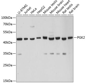 PGK2 Rabbit Polyclonal Antibody