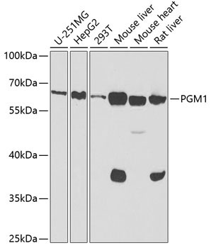 PGM1 Rabbit Polyclonal Antibody