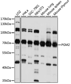 PGM2 Rabbit Polyclonal Antibody