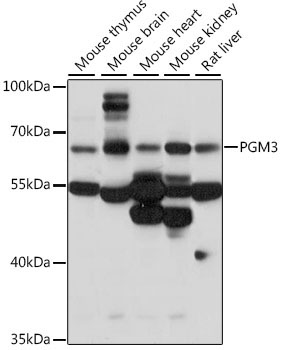 PGM3 Rabbit Polyclonal Antibody