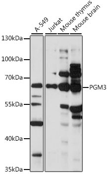 PGM3 Rabbit Polyclonal Antibody
