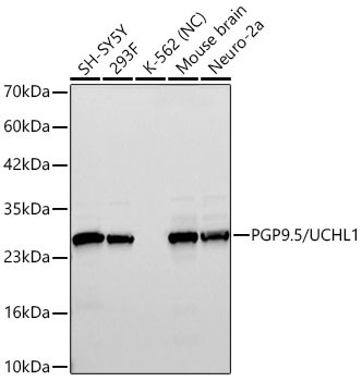 PGP9.5/UCHL1 Rabbit Monoclonal Antibody