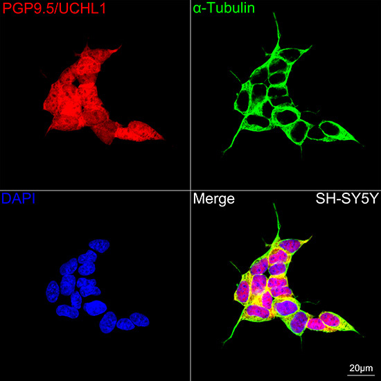 PGP9.5/UCHL1 Rabbit Monoclonal Antibody - Image 3