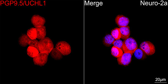 PGP9.5/UCHL1 Rabbit Monoclonal Antibody - Image 4